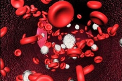 Гипокалиемия пониженное содержание в крови человека калия